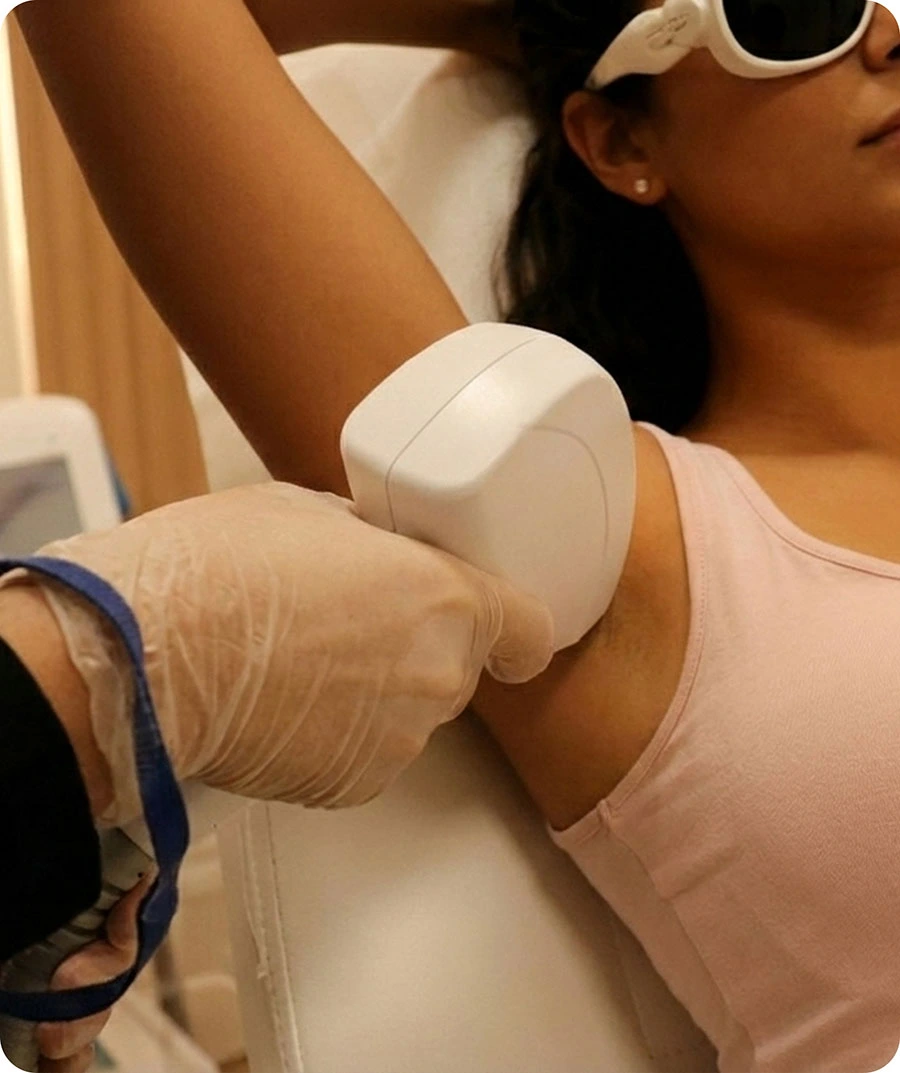  Why Clients Trust Sleek Laser Solutions for Underarm Laser Hair Removal 