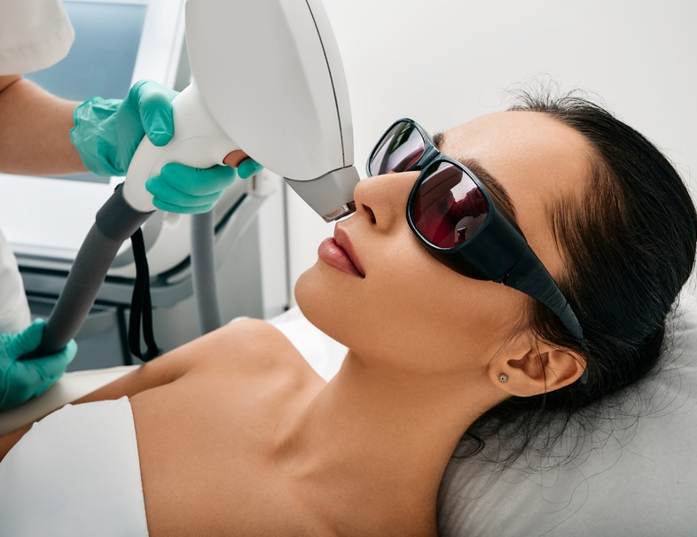 Facial laser hair removal treatment areas at Sleek Laser Solutions